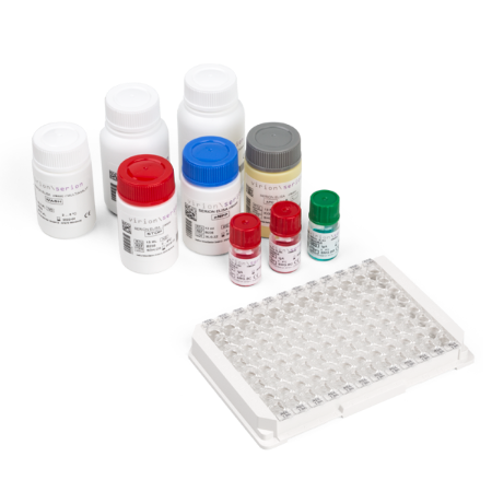 Prueba Serion Elisa Classic para detección de Herpes Simplex Virus 2 (HSV2) en Anticuerpos (IgG) en Reactivo - Virion\Serion
